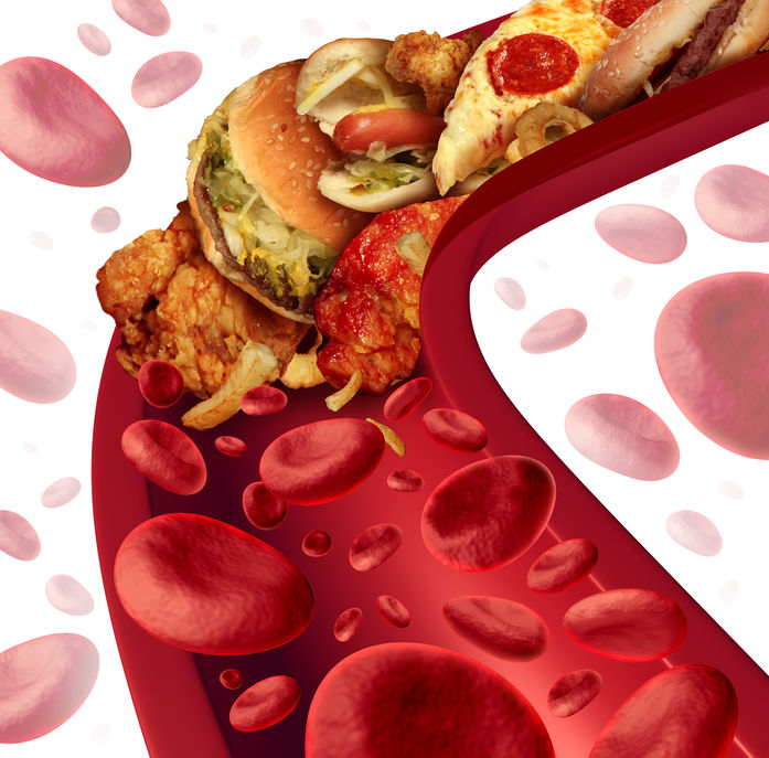 Hamburger and fries in the artery causing a blood clot.